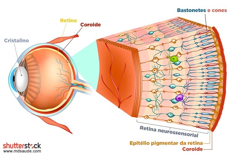 Descolamento de retina: sintomas e tratamento